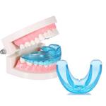 фото G-Tooth Trainer – инновационная брекет-система для выпрямления зубного ряда